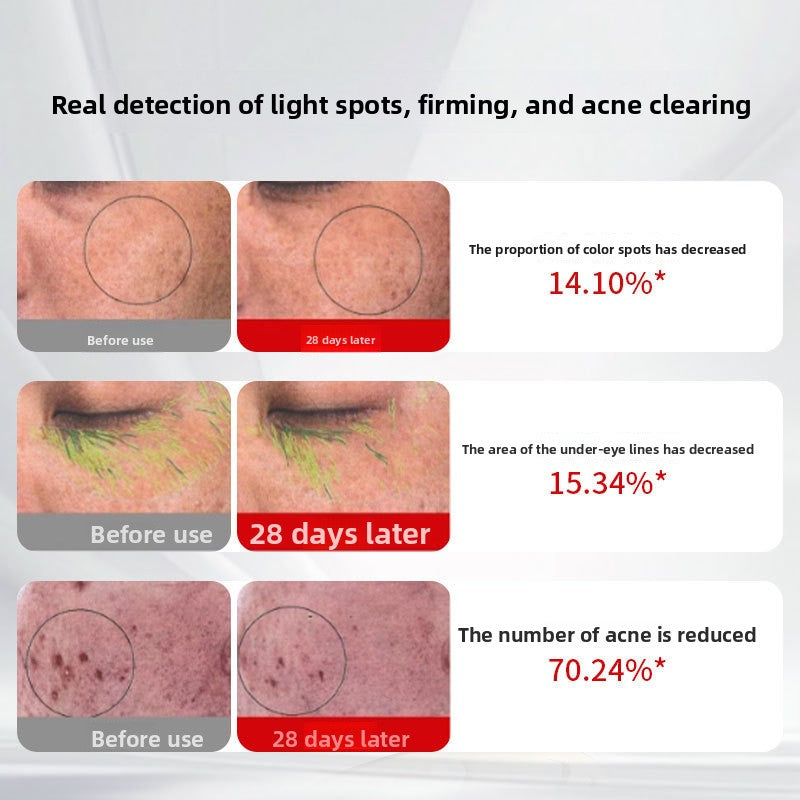 Multifunctional LED Photon Facial Mask Device